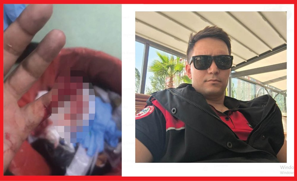 Madde Bağımlısı Isırarak Polis Memurunu Yaraladı 