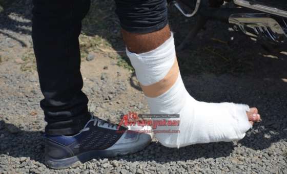 Kırık Ayaklı Ehliyetsiz Motosiklet Sürücüsü Şaşırttı